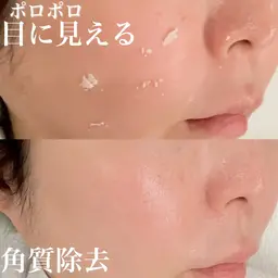 3月限定40%OFF★酵素ピーリング角質ポロポロ★天然由来成分でダウンタイムなし！