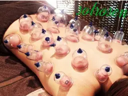 ⭐ ミニモ限定|カッピング20分+強圧ドライヘッド10分 肩こり