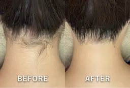 【1回で実感◎施術人数4万人突破記念✨】うなじ脱毛シェービング付◎首元すっきり首長美人✨初回¥4,500