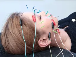 《お試し美容鍼》小顔/えら解消/むくみ/たるみ/肌荒れ改善　美容鍼、鍼を受けたことがない方にオススメ✨