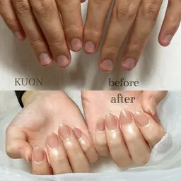 口コミ割引🉐オフ無し深爪矯正【スカルプネイル】深爪さんのお爪を自然に細長く形成！ワンカラーorグラデーション