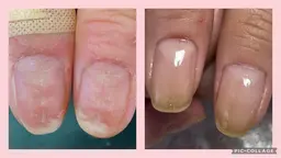 自爪育成　（深爪など）　ケア、ジェルクリア仕上げ