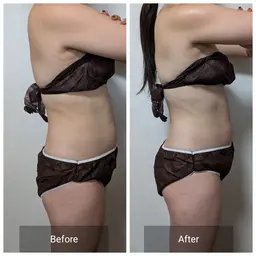 上半身すっきりセルライトケアコース40分エステ