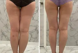 全身筋膜コース《痩身》　一度で効果を体験したい方にオススメ！お身体引き締めと痩せやすい身体作りを実現◎