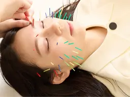 【minimo限定】美容鍼+小顔矯正のモニター様✨毎月限定5名様✨募集中