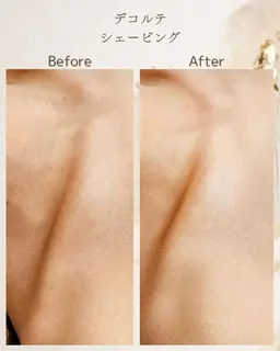 【顔とデコルテ】お顔&デコルテシェービング
