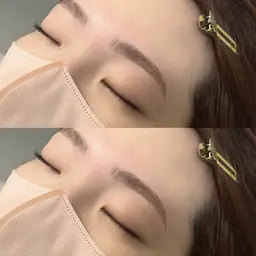 《ハリウッドブロウリフト》