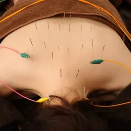 ⚠️期間限定[💥首・肩コリに]🍀全身鍼＋パルス＋マッサージ　90分