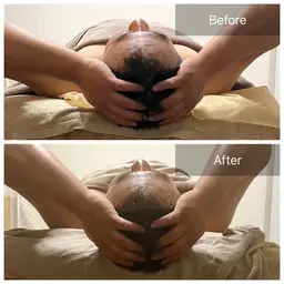 【ミニモ限定価格】脳疲労/小顔/肩コリ【小顔ドライヘッドスパ＋デコルテ70分】¥14,000→¥8,800