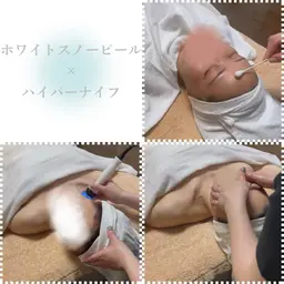 【Wケア＋】肌×首・デコルテ：ピーリング＋ハイパーナイフ→ 150分 ¥15,400