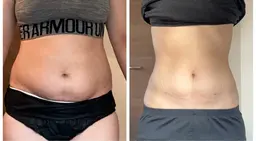 身体のお悩み無料カウンセリング