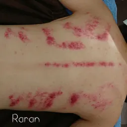 【オプション🚩】フェイシャル、ボディエステと一緒に💕【背中デトックスかっさ】マッサージ付き