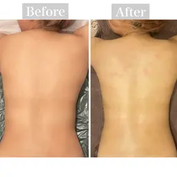 【肩こり・生理痛・足の浮腫み】オイルマッサージ🌿(18~29歳限定)