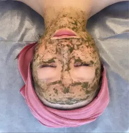 ハーブピーリング1g¥5,500＋【小鼻🍓毛穴黒ずみ】パックプレゼント🩶