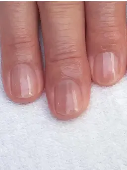 ハンドネイル【ケア】