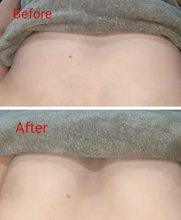 上半身集中(バストケア)