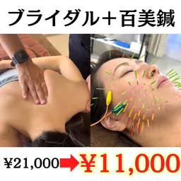 【✨ミニモSALE✨】ブライダル整体×百美鍼(100分)（美容鍼100本/小顔/肩甲骨はがし/姿勢矯正）