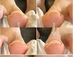 期間限定✨【１本¥4500➡️¥2000​〜​3000】➕ワンカラー（合計¥10000​〜​12000）