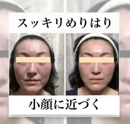【リフトアップ】肌質改善フェイシャル+高濃度美容成分