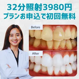 【7300円⇒3980円】国内最高65Wマシン・32分(16分2セット)照射ホワイトニング