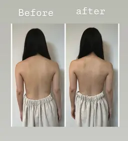 【挙式直前・撮影前1day完結】熟練の極上ブライダルフルコース(美顔・痩身・姿勢・シェービング込)💝