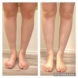 キャビテーション20分➕リンパドレナージュ10分