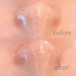 ［🔥ミニモ限定50%OFF🔥❣］毛穴ケア✨毛穴洗浄➕小鼻ワックス➕保湿マスク💜*