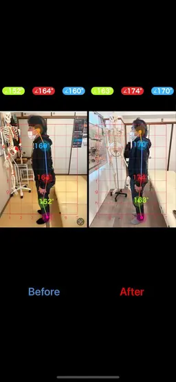 2回目以降　姿勢矯正整体(猫背矯正)