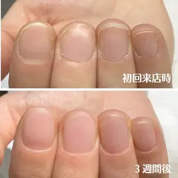 自爪育成ネイルケア＆クリアジェルネイル(２回分)