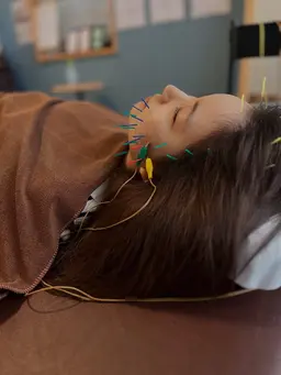 美容鍼(スペシャル)ヘッドマッサージ付 ×ぐっすり眠れる整体35分