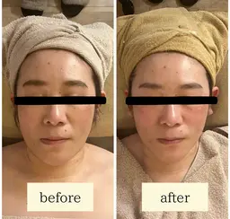 【お顔の悩み解消】コルギフェイシャル（モデリングマスク付き）70分