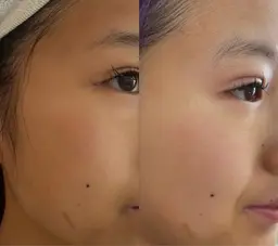 フェイシャルエステ初回500円!