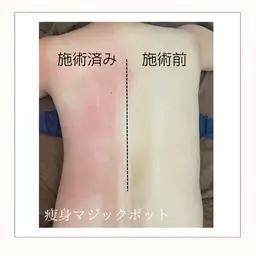 【本気痩せ!全身燃焼コース】温活×痩身🔥よもぎ蒸し30分+マジックポット全身120分