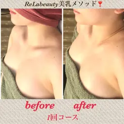 姿勢矯正×光豊胸+ナノカレントのW効果のバストアップコース❣️背中からしっかり引き上げ、ワキ肉もスッキリ✨