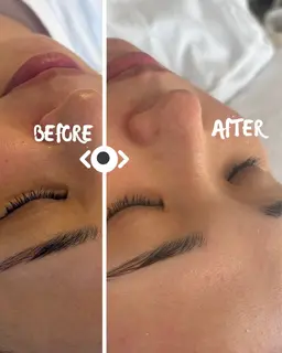 アイブロウ➕おでこ艶肌Wax脱毛