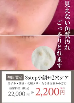 4月限定3step小顔+【毛穴ケア】見えない角質汚れがとれるクレンジング付100min ¥24,200→¥4,400