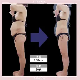 【全身痩身90分】ラジオ波×キャビテーション×近赤外線×吸引　¥10000　むくみ脂肪太りに！何度でも同価格◎