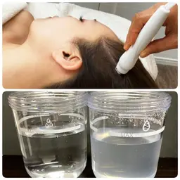 【毛穴洗浄スカルプケア】頭皮の汚れを水素水で洗浄吸引+エッセンススプレー！通常￥6500→￥3500/支払い現金
