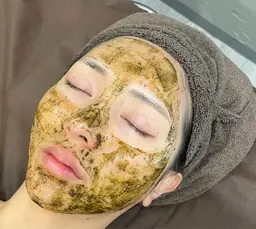 【剥離しないハーブピーリング🌿】安心安全の国産のハーブ使用で毛穴・ニキビ・たるみでお悩みの方へ❣️美白効果も◎