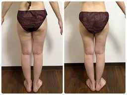 ミニモ学割/U24✨下半身が痩せにくい方のウィンバック足痩せコース✨セルライトが気になる方に‼️お気に入りに登録者限定♪