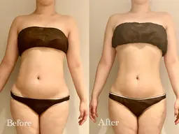 ※スタッフ🈯️⏰人気No.1メニュー✨🉐【短期間でサイズダウン🔥】全身痩せ90分コース