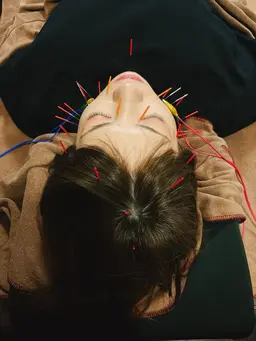 💆♀️美容鍼➕リンパマッサージ➕首肩マッサージ✨