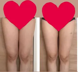 【足痩せ】スラっとフラミンゴ足に🦩✨キャビ+カッサでセルライト・脂肪をゴッソリ落とす！足痩せsp🌟