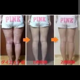 脚全体 裏 表 (太腿 とふくらはぎ)のダイエット リピーターは12000円。お得な5回コース50000円になります。