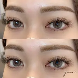 バインドロック 300本(100束)