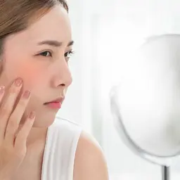 【初回限定!!!2ヶ月集中肌質改善】¥500円 2回コース ニキビ/皮脂過多/赤ら顔/シミ/毛穴/たるみ/くすみ