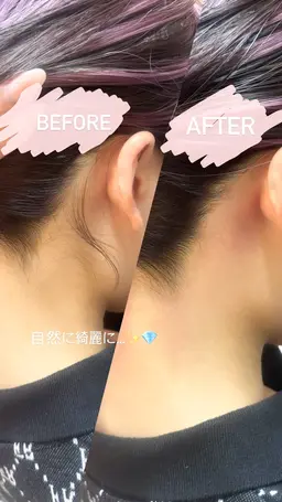 うなじwax🫧¥3000