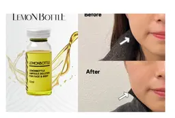 【毛穴洗浄+高濃度酸素注入+美容液導入】《小顔たるみケア》超高濃度美容液🍋リフトアップ!気になる脂肪に!