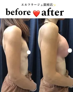 【🌸minimキャンペーンプラン🌸】大好評につきグラマラスコース特別価格￥41800→￥4,400