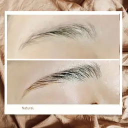 ハリウッドブロウリフト